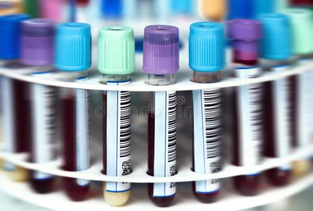 rack-blood-tubes-samples-centrifuge-tray-workbench-lab-108475885